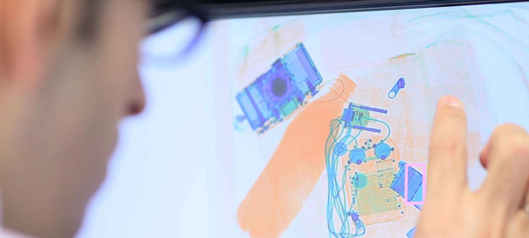 person viewing xray from CTiX